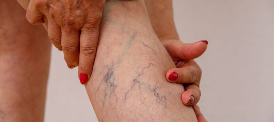 Zakonet e përditshme që mund të dëmtojnë venat tuaja