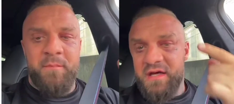 I nxirë dhe me plagë ende të pashëruara ne fytyrë, Medi Iseni publikon video për herë të parë pas sherrit me Noizy-n: Çdo gjë…