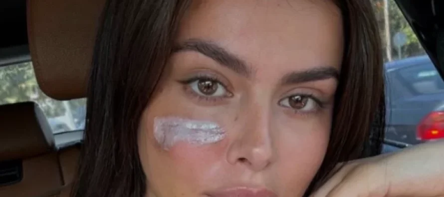 Incidenti me motrat Berisha – modelja shqiptare tregon gjendjen shëndetësore
