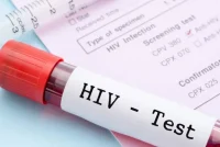 RMV: 11 raste të reja me HIV/AIDS gjatë korrikut, shumica meshkuj