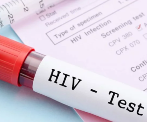 RMV: 11 raste të reja me HIV/AIDS gjatë korrikut, shumica meshkuj