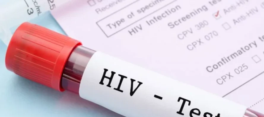 RMV, pesë raste të reja me HIV dhe dy raste me SIDA janë konfirmuar në korrik