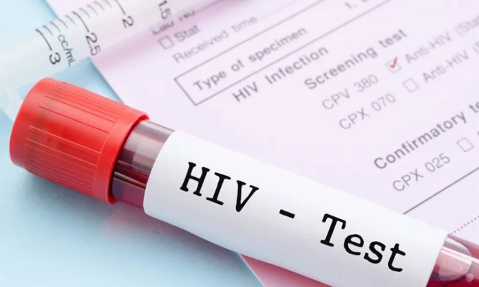 RMV  11 raste të reja me HIV AIDS gjatë korrikut  shumica meshkuj