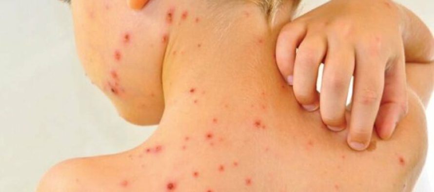 Fruthi konfirmohet tek një 12 vjeçar nga Konjari i Poshtëm