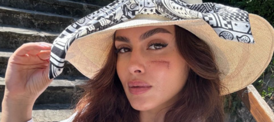 Klea Prenga publikon fotografi të reja në Instagram, plaga ende e dukshme në fytyrën e saj