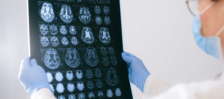 E ardhmja e mjekësisë: Nanorobotët e krijuar që hyjnë në tru dhe ndalojnë gjakderdhjen