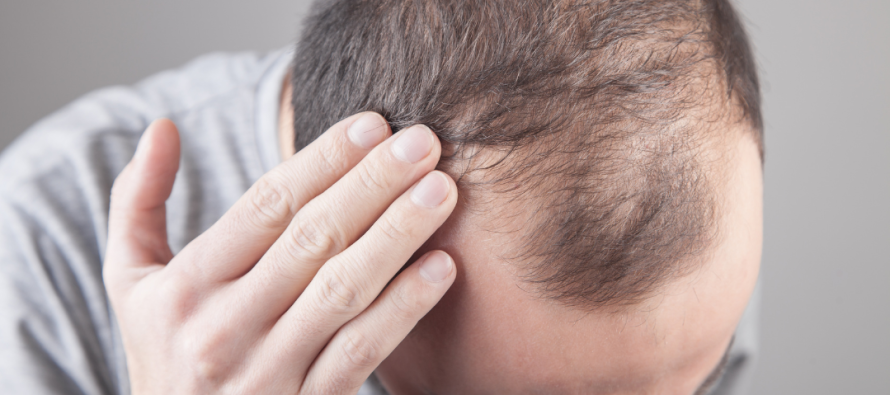 A po humbni shumë flokë? Ja si ta kuptoni sipas shkencës