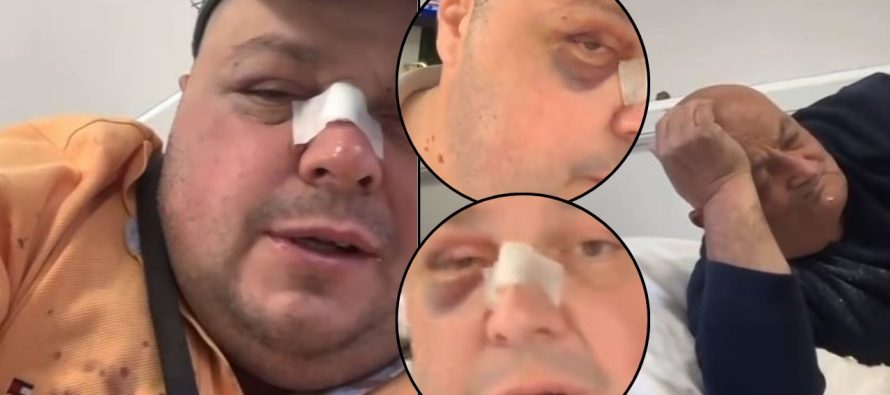 Genard Hajdini dhe babai i tij dhunohen në Tiranë – Përfundojnë në spital