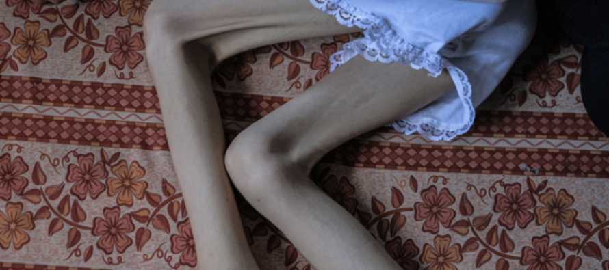 Uria ekstreme paralizon vajzën 9-vjeçare në Gaza