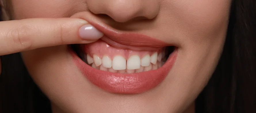 Problemet me mishrat e dhëmbëve? Ja si t’i lehtësoni natyralisht
